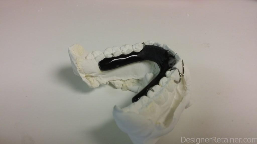 Finished 2 - Add Sprint to Retainer