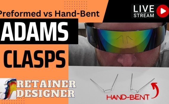 Adams Clasps: Preformed vs. Hand-Bent, Which is better?