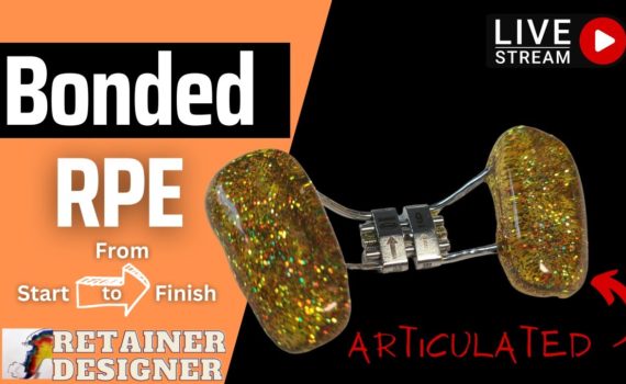 Constructing a Bonded RPE: From Start to Finish!