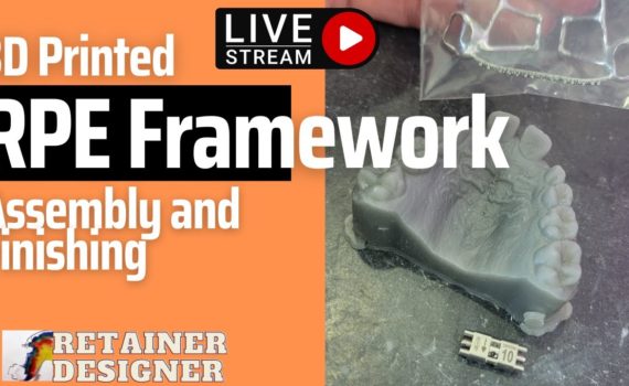 3D Printed RPE Framework: Assembly time!!