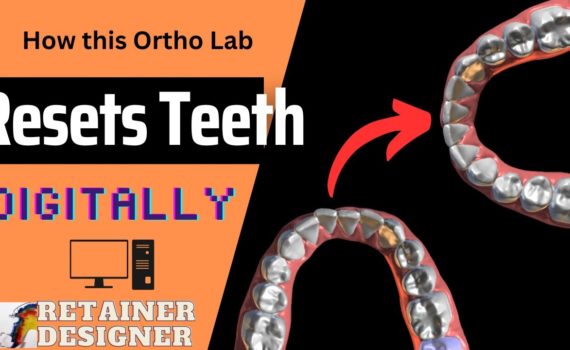 How This Orthodontic Lab Straighten Teeth: Digitally!
