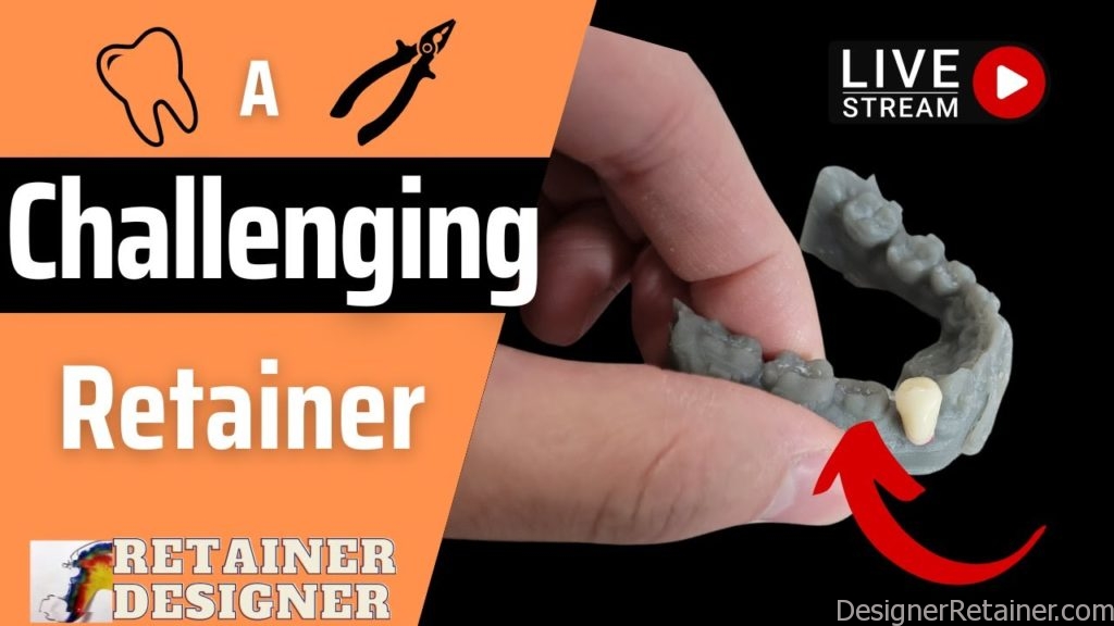 Retainer Design Service Live Stream: A Challenging Lower Retainer – Retainer Designer ...