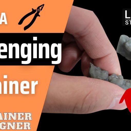 Live Recording – My Tricks for removing a Retainer with Labial Acrylic ...