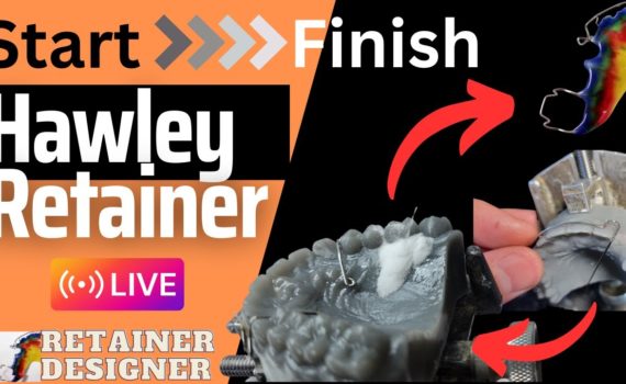 Watch as I Create a Hawley Retainer Start To Finish LIVE!
