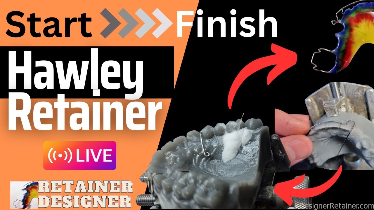 Retainer Design Service Watch as I Create a Hawley Retainer Start To Finish LIVE! – Retainer ...