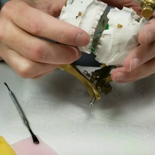 Wire Wednesday #25: Twin Blocks Part 3