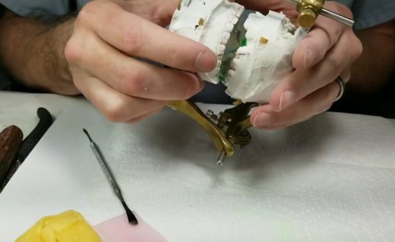 Wire Wednesday #25: Twin Blocks Part 3