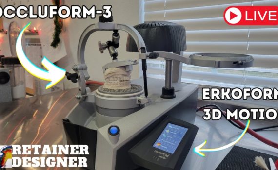 Lets make a splint on a Erkoform w/ Occluform-3 attachment