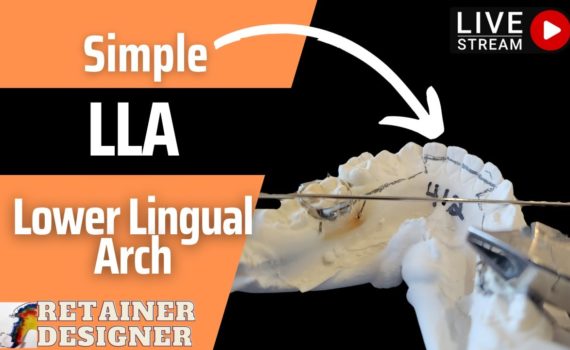 Live Stream: A Simple Lower Lingual Arch (LLA/LLHA)
