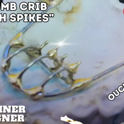 [Habit Appliance] Let's Make a Thumb Crib " With Spikes"!