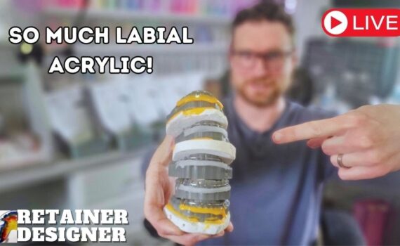 [Acrylic Application] So Much Labial Acrylic! My Pressure pot is dead :(