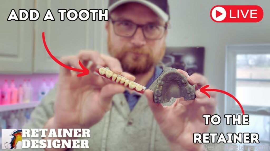 Adding a Tooth (Pontic) To a Retainer. Plus A Bonus Tip! – Retainer ...