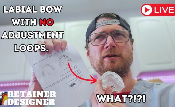 Lets Make A Retainer with a Labial bow with no adjustment loops. What?!?!